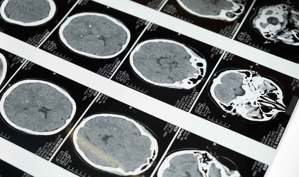 Clinical Applications of Brain Imaging Technologies Possible Future Implications (1)